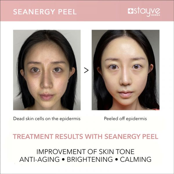 deep-exfoliation-pore-cleansing-peel-gccdeep-exfoliation-pore-cleansing-peel-gcc