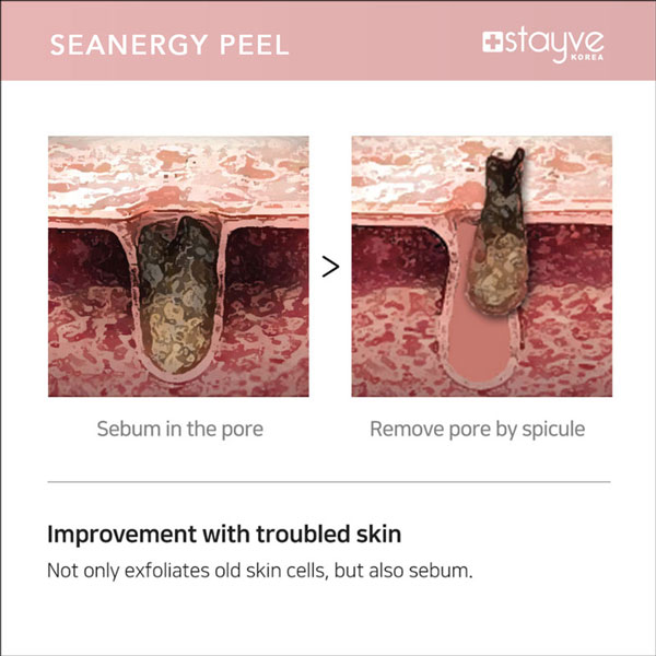 stayve-peel-collagen-elastin-stimulation