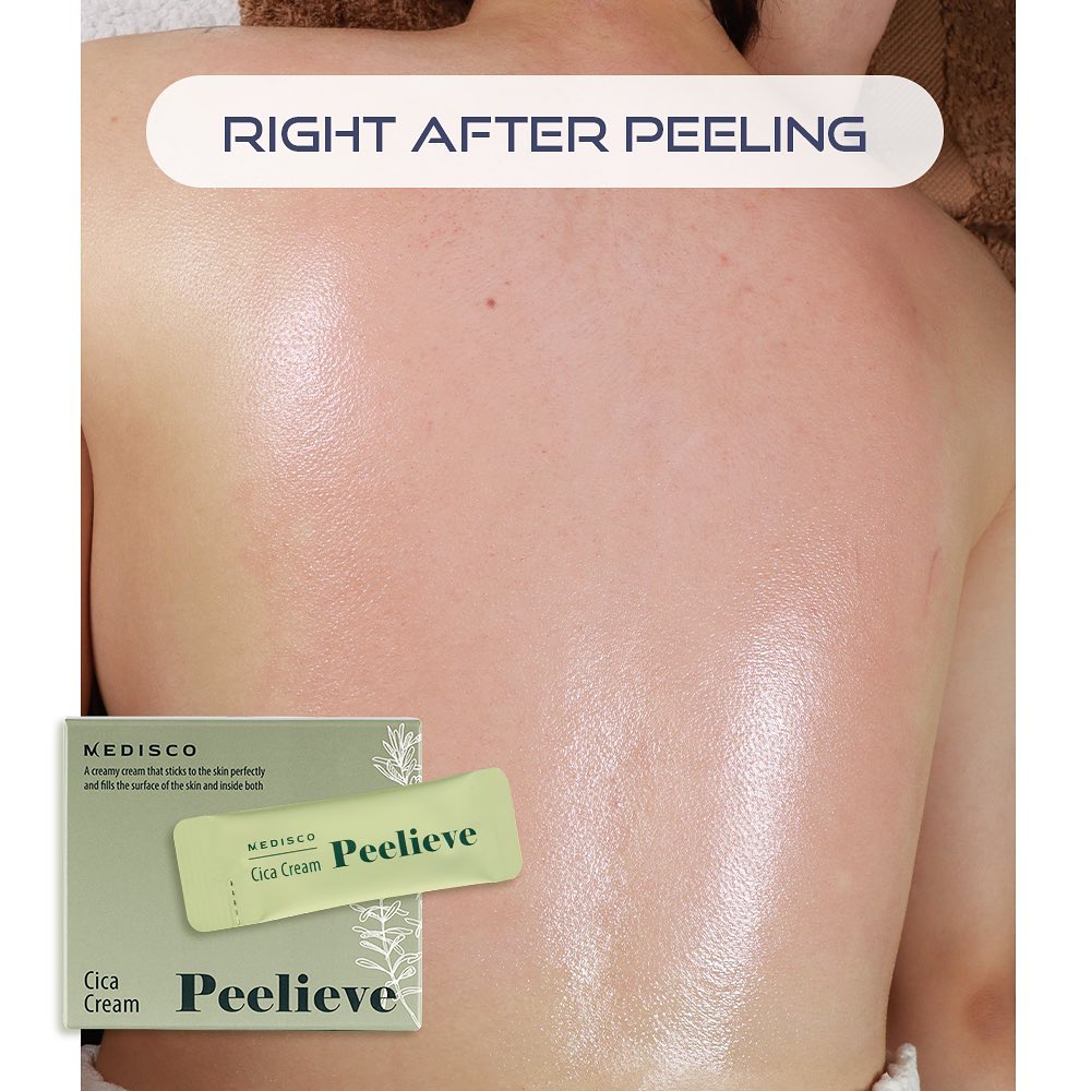 peelieve_skincare_1