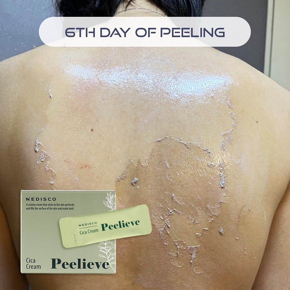 peelieve_skincare_2