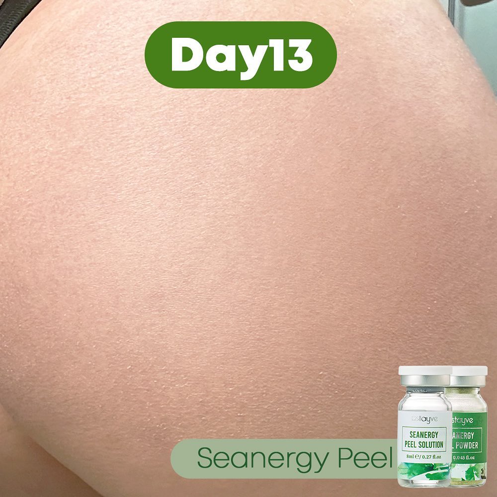 seanergy_peel_1