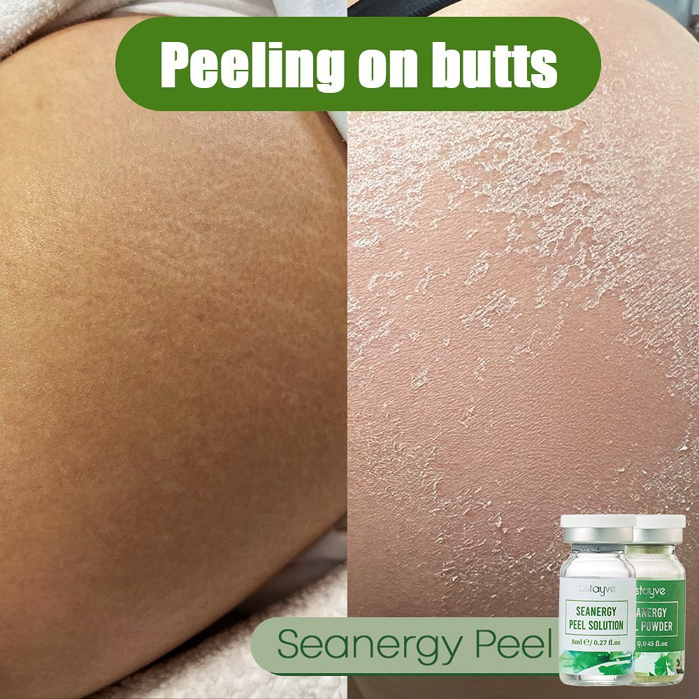 seanergy_peel_4