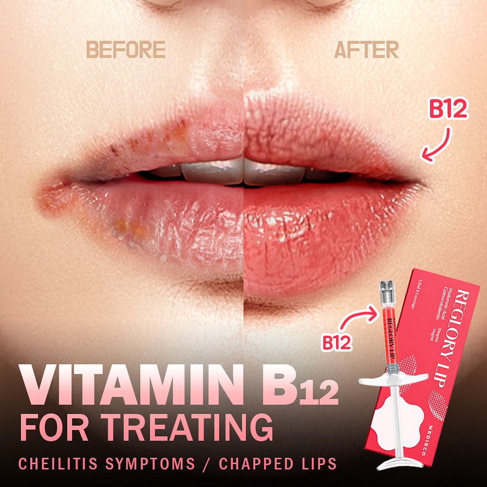 reglory_lip_stayve_lip_filler_vitamin_b12_lip_filler_01