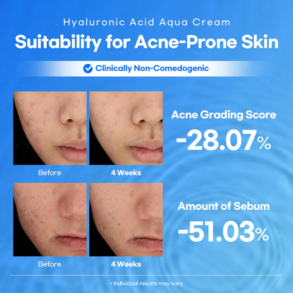 2_1_Lesimo_Hyaluronic_Acid_Aqua_Cream_thumbnail.webp