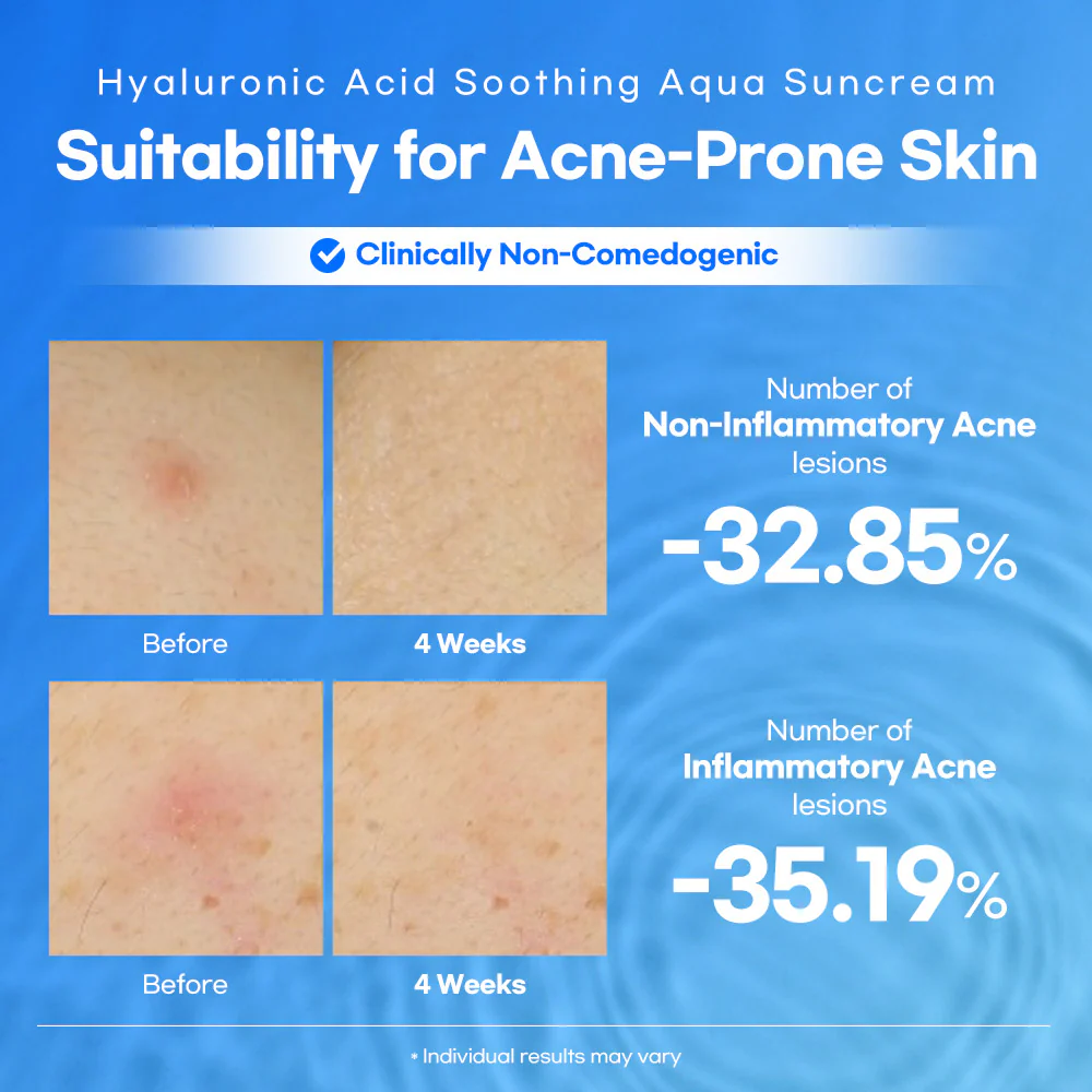 2_1_Lesimo_Hyaluronic_Acid_Soothing_Aqua_Suncrea_thumbnail.webp