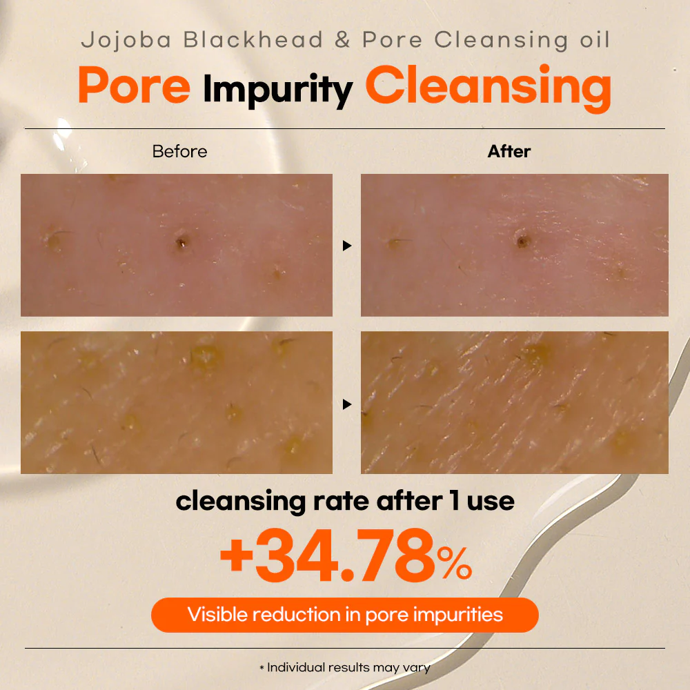 Top_rated_Lesimo_Jojoba_Blackhead_Pore_Cleansing_oil_thumbnail.webp