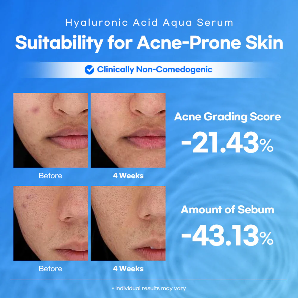 best-hyaluronic-acid-serum-for-anti-aging-gcc-skincare.webp